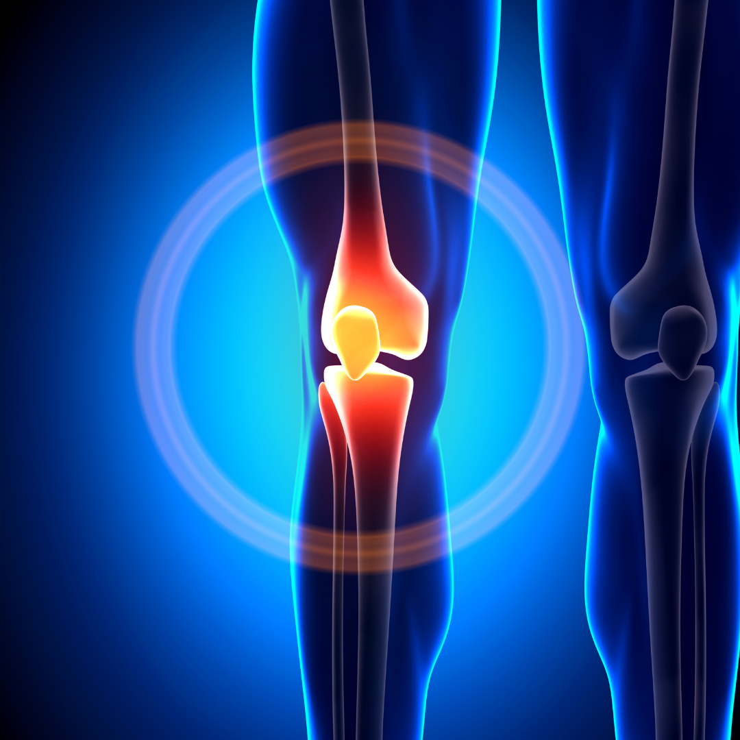 new knee replacement technology 2023